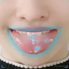 智能中医舌诊-中e诊