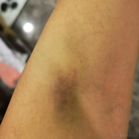 书包肚肚于2022-06-23 09:19发布的图片