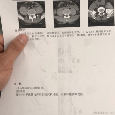 三天摸鱼两天躺平于2021-06-28 21:44发布的图片