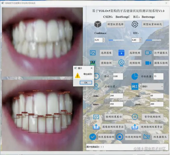 高精度牙齿健康状态检测识别系统2342.png