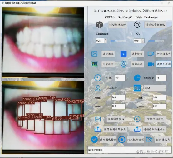 高精度牙齿健康状态检测识别系统2979.png