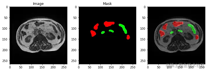 output_17_1.png