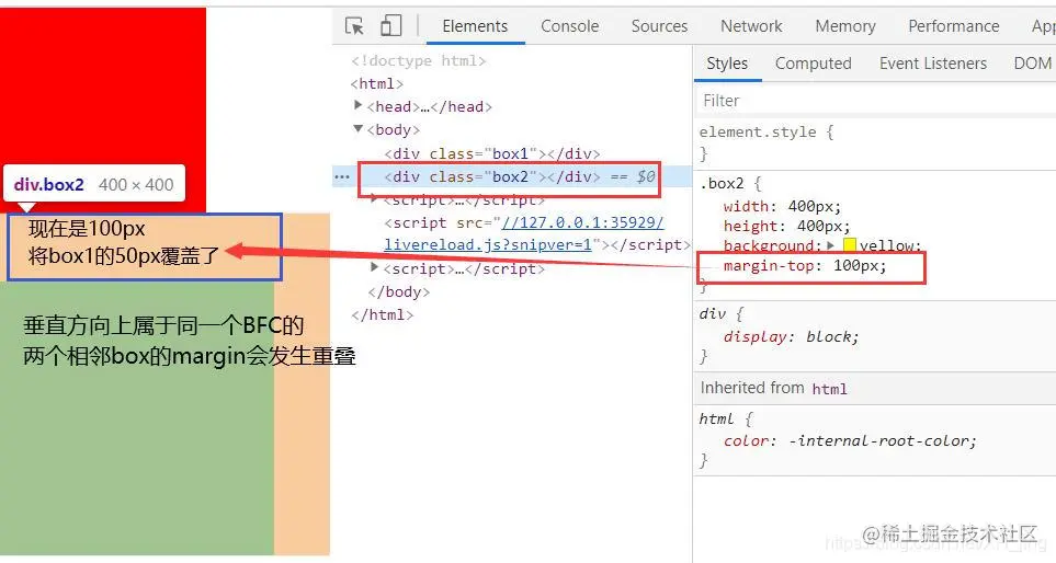 两个相邻的box的margin会发生重叠